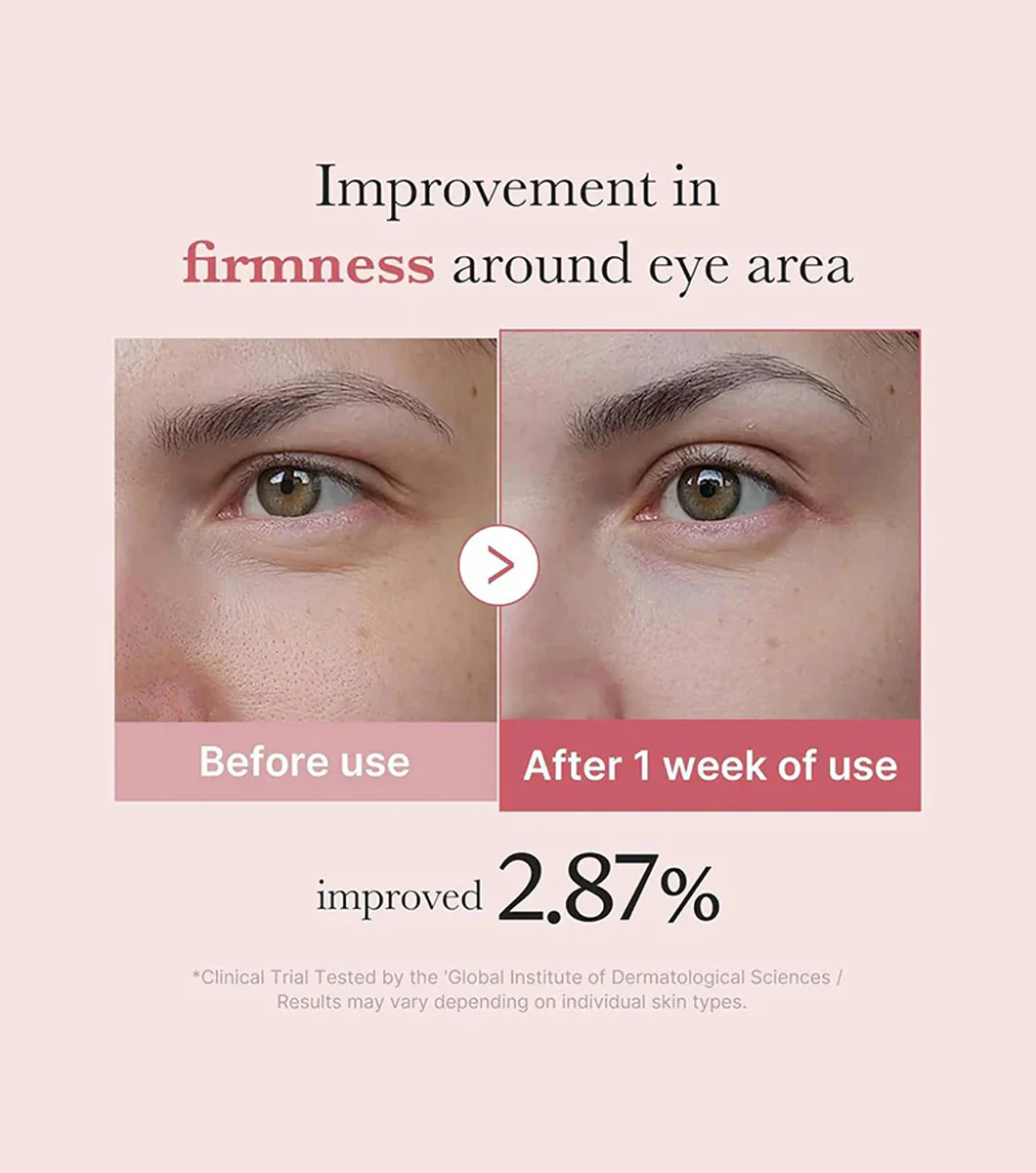 MEDICUBE | Pdrn Pink Peptide Eye Cream 30ml - Image 4